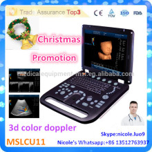 Promotion de Noël! CU11-i Nouveau prix avancé de la machine à ultrasons 3D et échographie doppler couleur 3d pour la clinique